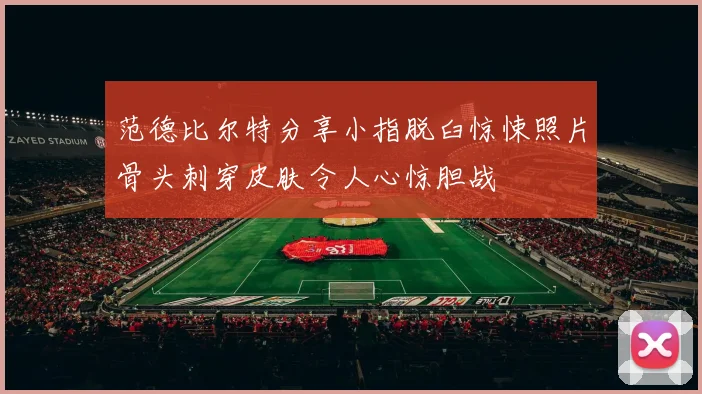 范德比尔特分享小指脱臼惊悚照片骨头刺穿皮肤令人心惊胆战